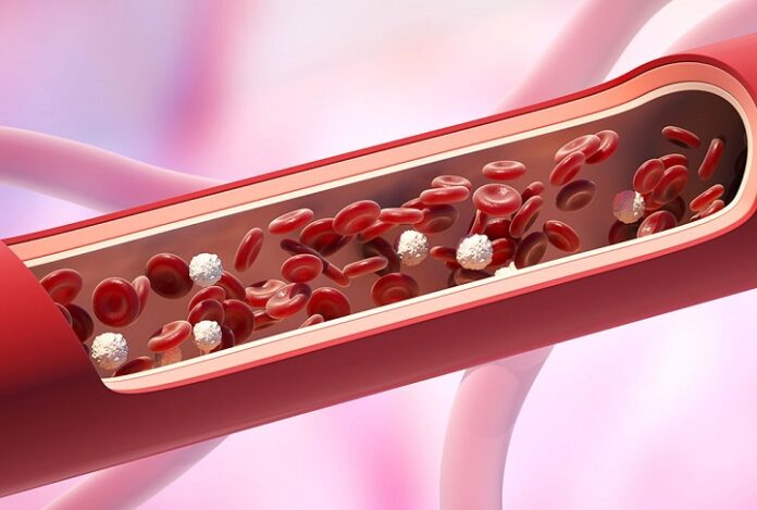 cancer-en-la-sangre